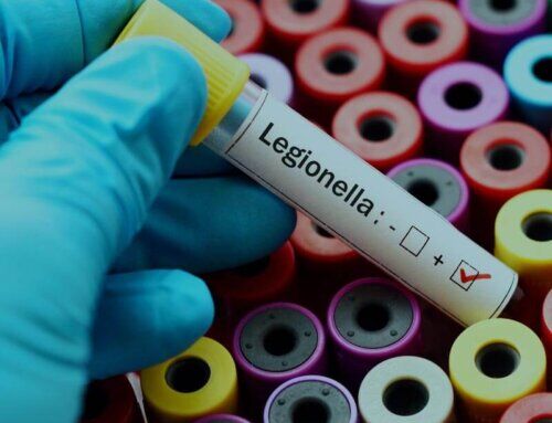 Legionella Safety in Building Water Systems