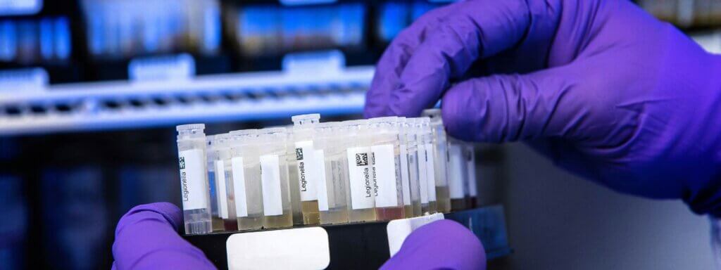 Gloved hand sorting through vials of different coloured liquids with the labels stating 'Legionella'.